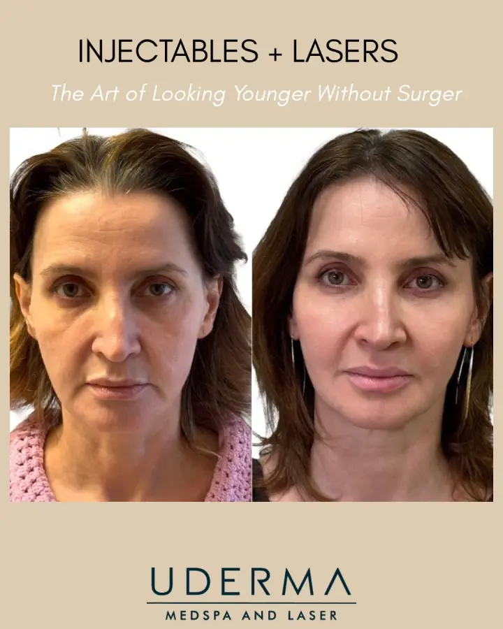 Every face ages differently, which is why every treatment plan at UDERMA is…