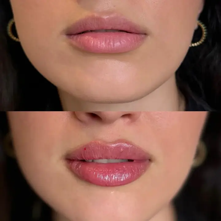 Beautiful lips don’t have to look overdone