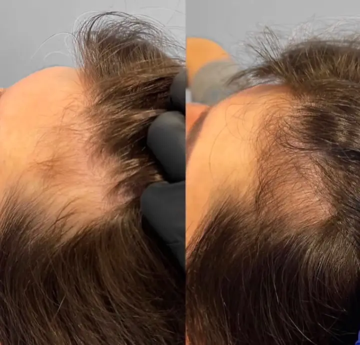 Thinning hair doesn’t have to be permanent