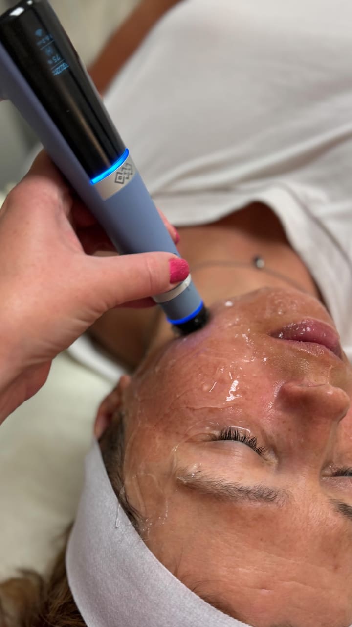 "Discovering the natural way to boost hyaluronic acid production with Exion ultr
