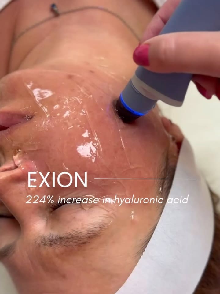 224% Hyaluronic acid