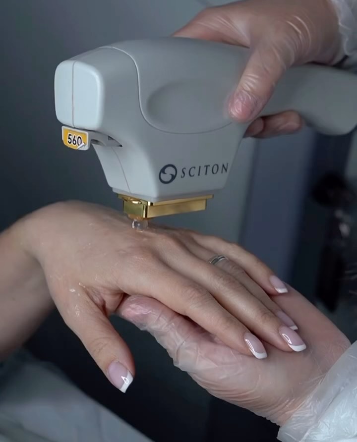 BBL HERO effectively addresses a variety of skin concerns using advanced BroadBa