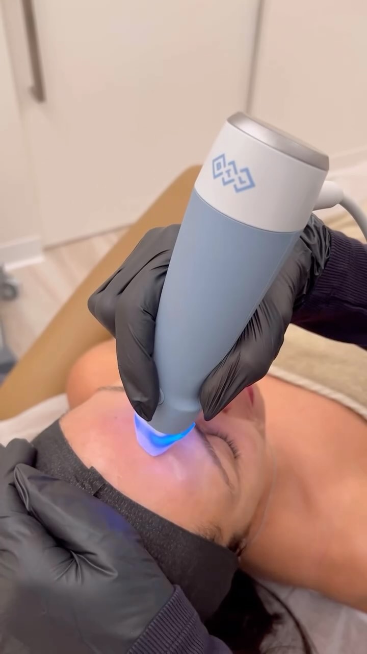 Amazing Skin And No Need For Makeup Guaranteed
