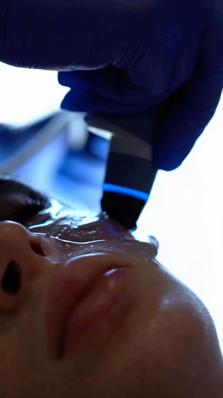 Exion Ultrasound Face Treatment
