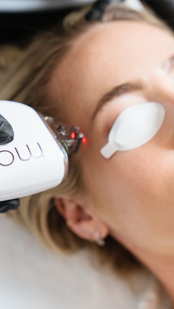 Moxi Laser is a non-ablative fractional laser designed for skin rejuvenation wit
