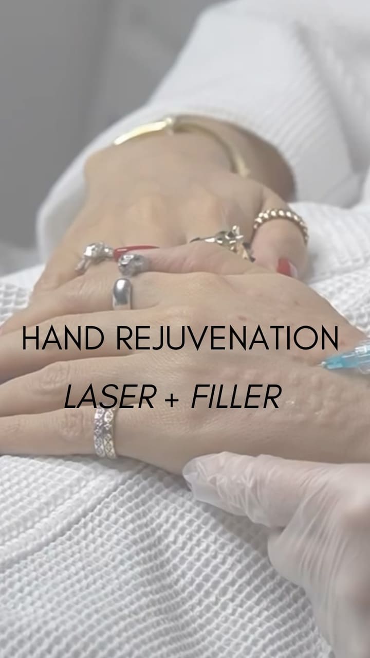 Hand Rejuvenation