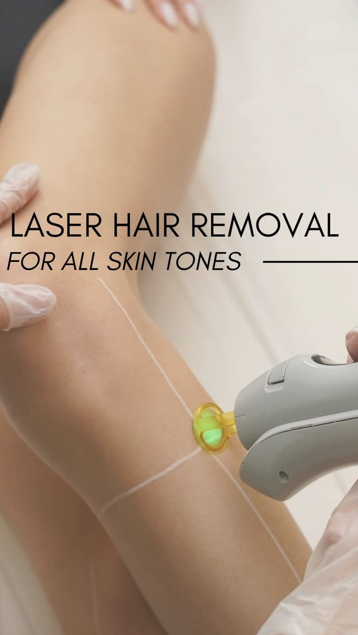 Laser Hair Removal with Candela GentleMax Pro
