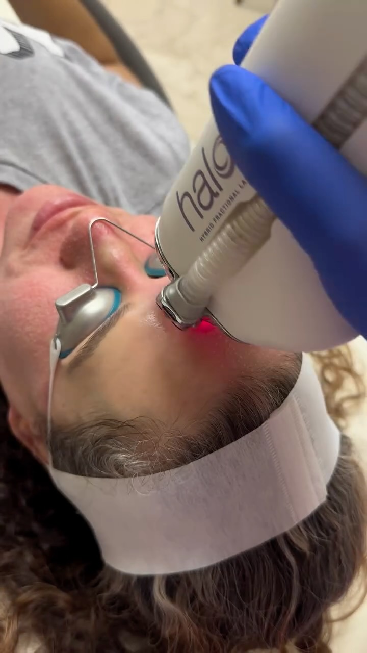 Texture, Wrinkles & Loose Skin Tightening