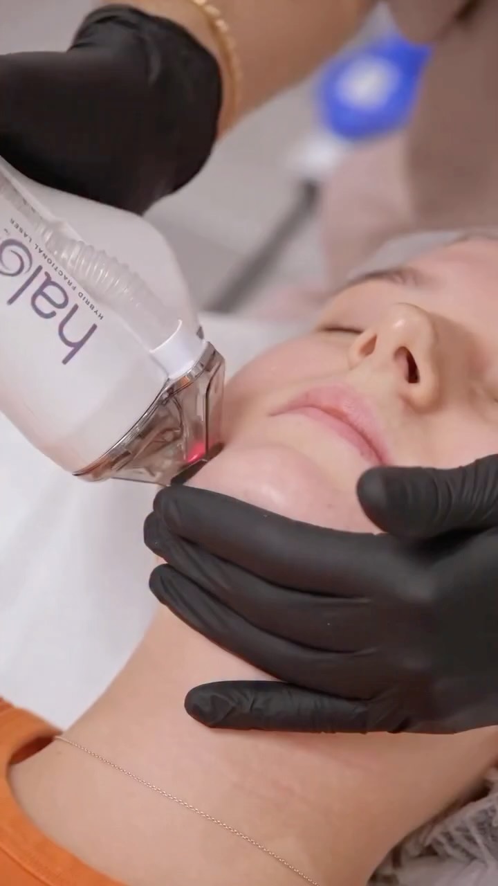 The ONLY Hybrid Fractional Laser on the market