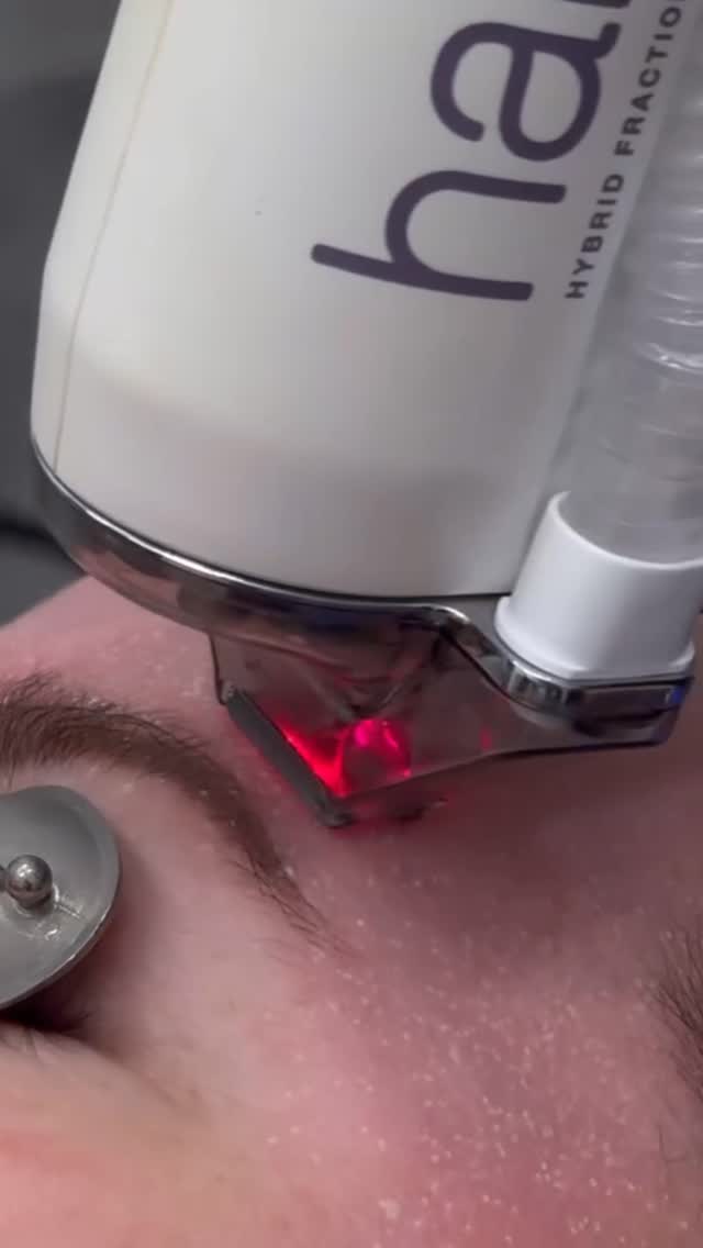 We’re obsessed with Halo Laser results