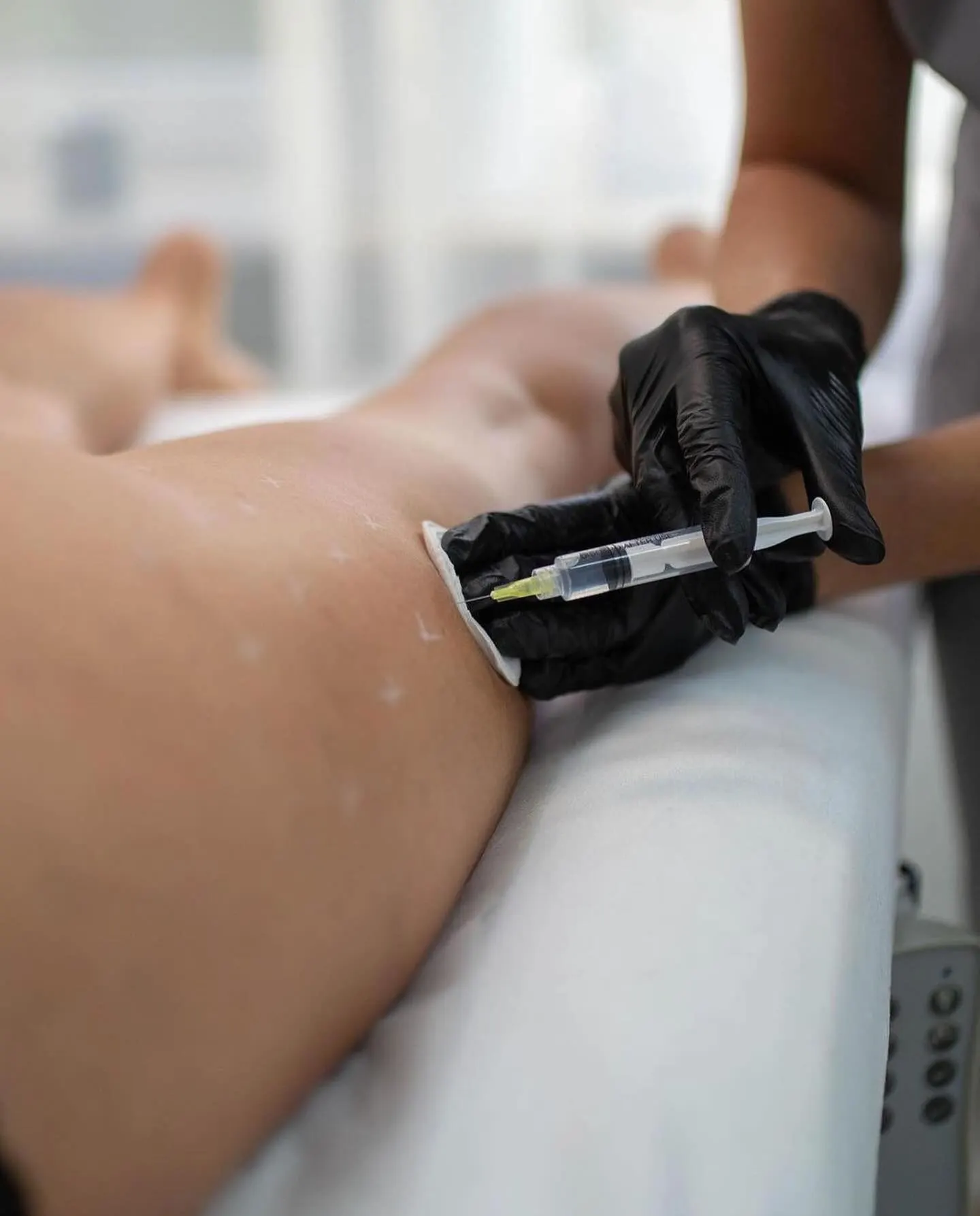 Lipo-dissolving injectables, also known as injection lipolysis or fat-dissolving injections, are non-surgical treatments