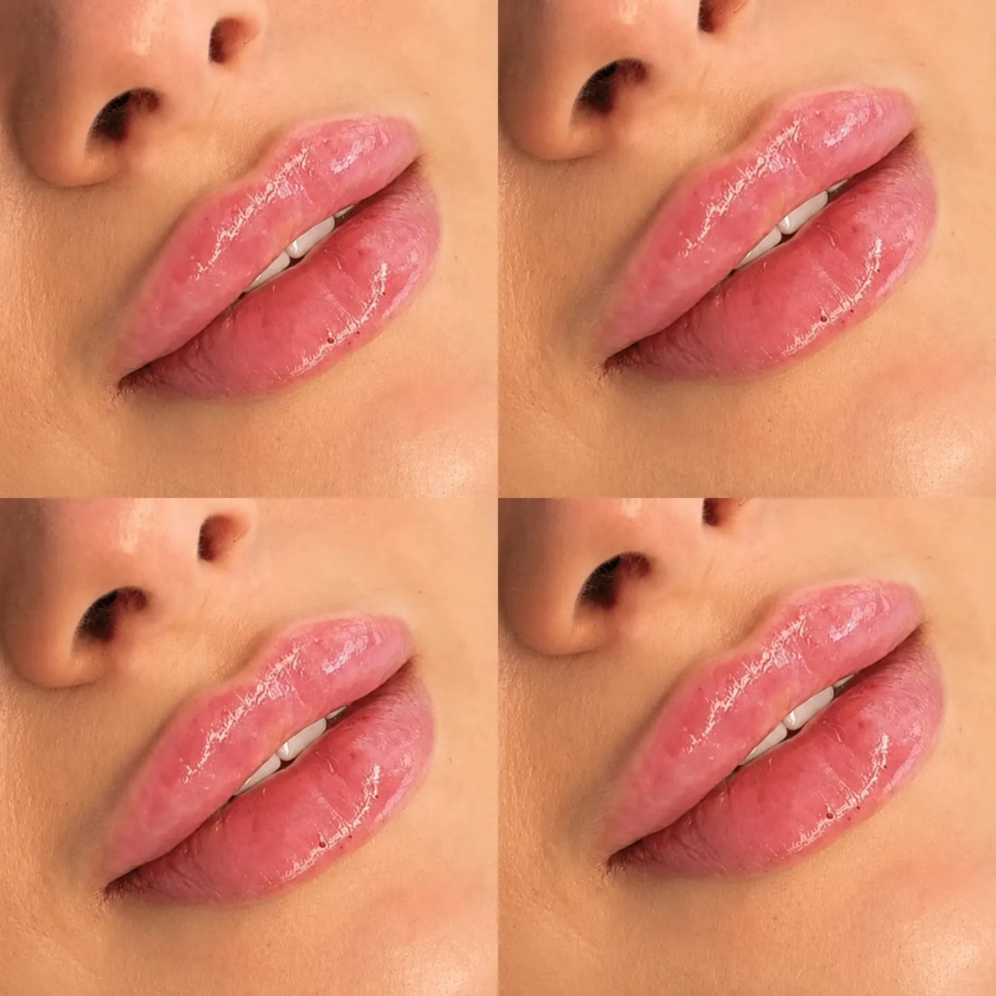 Warning: Side Effects May Include… 💋