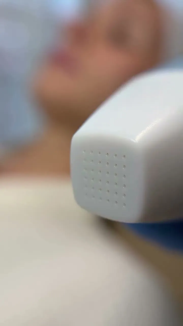 Looking for a skin-tightening treatment with minimal downtime that’s easy to tolerate?